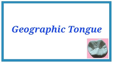 Geographic Tongue - Important Notes | Developmental disturbances of Tongue | Oral Pathology