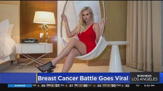 Breast cancer survivor's story goes viral Profile