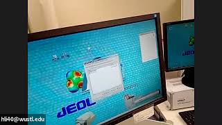 Celebrity 2100 TEM Training Video 6: Start observation Profile