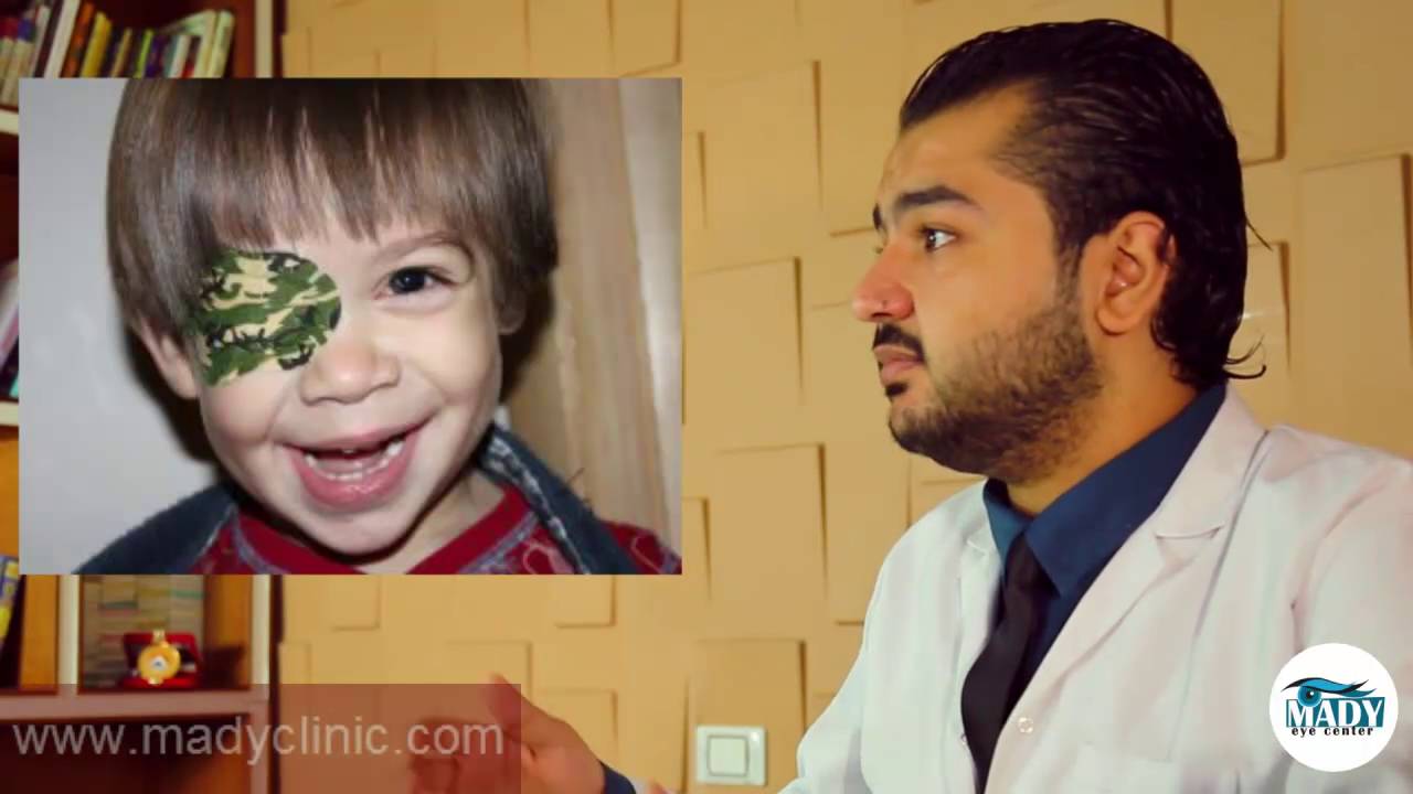 كسل العين  تعريف كسل العين وعلاجه وعلاقتة بعمليات الليزك