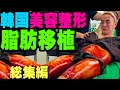 脂肪移植 韓国 美容整形 （ 脂肪注入 ） スペシャル総集編