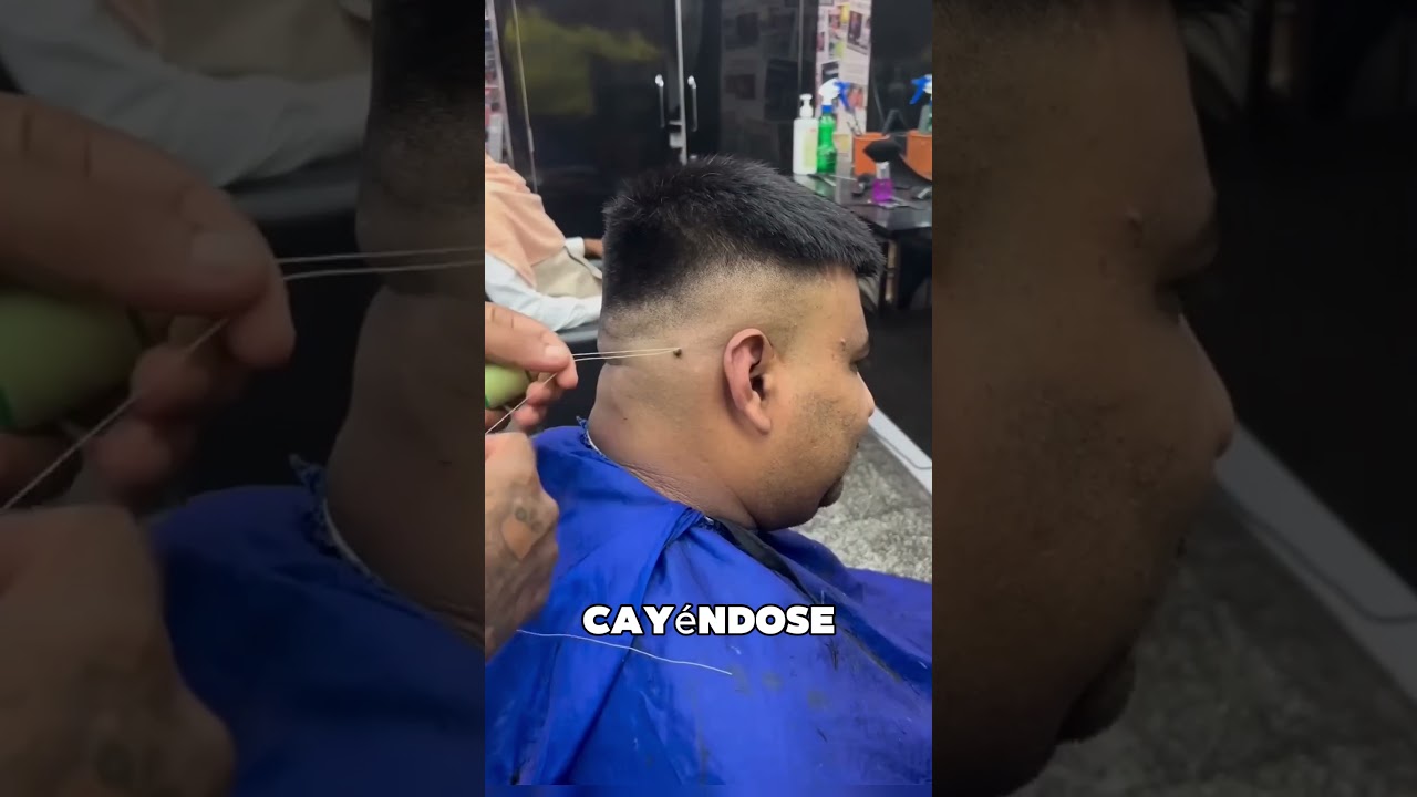 La Mejor Forma De Eliminar Verrugas De La Piel 😯❤️