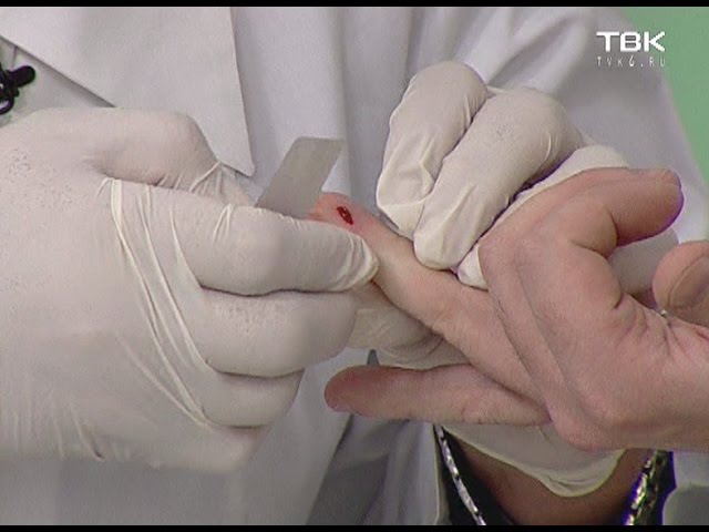 Экспресс-тест на ВИЧ-инфекцию