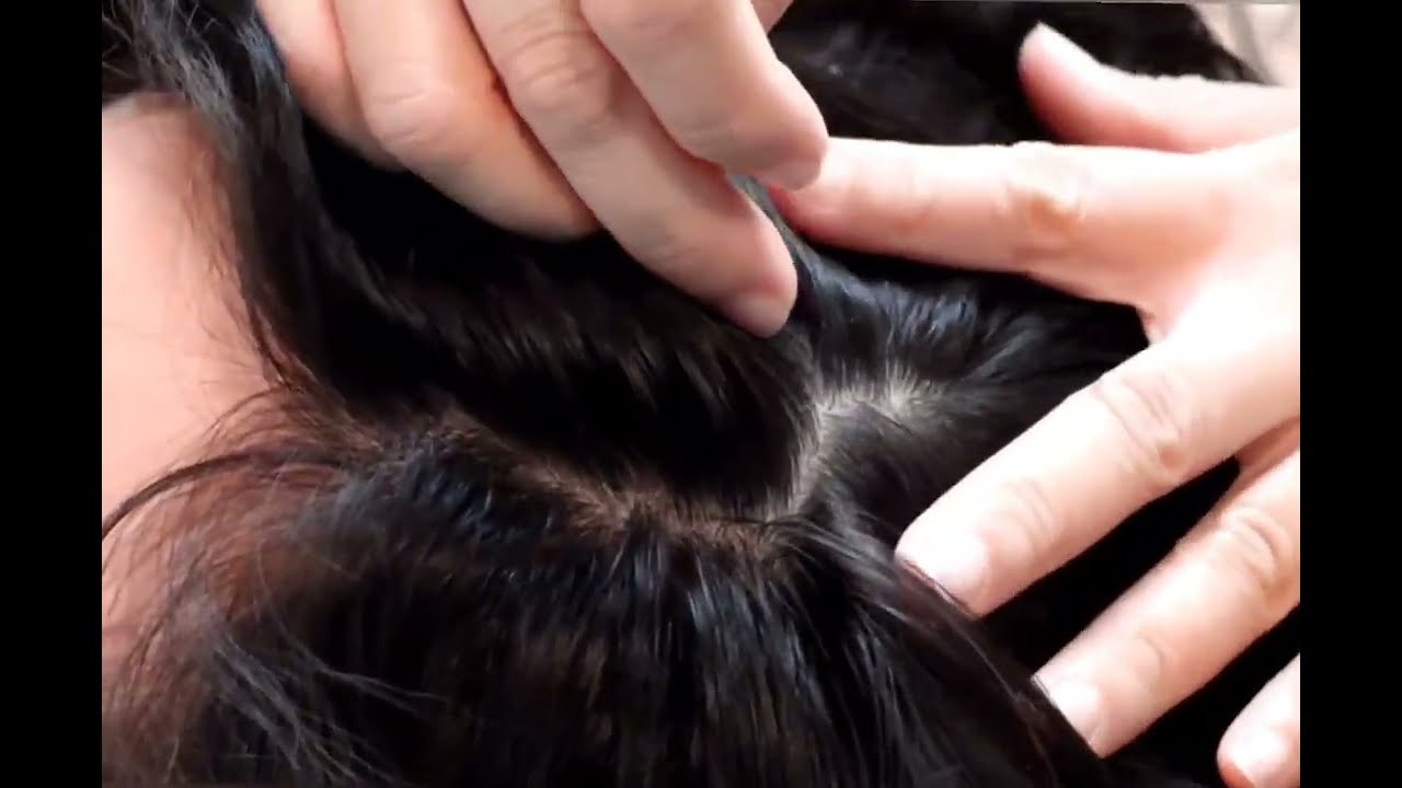 Asmr/ Nits picking 😌 😴 