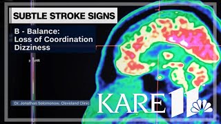 Know the subtle signs of strokes