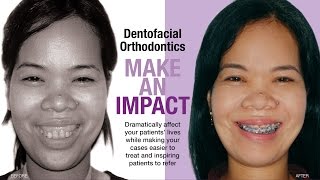 Dr. Dana invites you to PO Section 4 (Dentofacial Orthodontic Series)