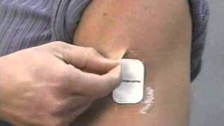 PharmChek Sweat Patch Removal