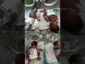 Escasez de incubadoras presiona a hospitales de Gaza
