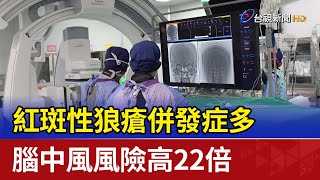 紅斑性狼瘡併發症多 腦中風風險高22倍