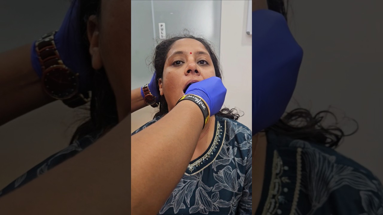 Treatment for DNS by Chiropractor Dr.Rajneesh kant 