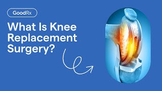 Everything You Need To Know About Knee Replacement Surgery | GoodRx