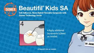 Shofu Beautifil Kids SA