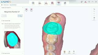 DL-300 software analysis function tutorial(Undercut, Margin Line)