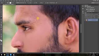 Photoshop Tutorial |  How to Quick Remove Spots From Face screenshot 4
