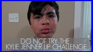 Do not try the kylie jenner lip challenge! | lifewithger vlogs (#23)