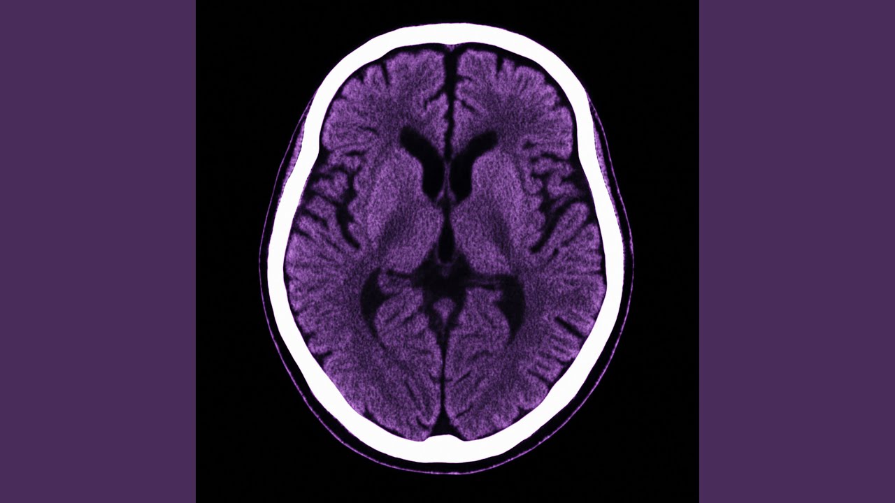 Chemical Haze Algorithm