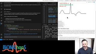 Exploring Fuzzy Logic in Flask: Enhancing ECG Biomedical Game with AI