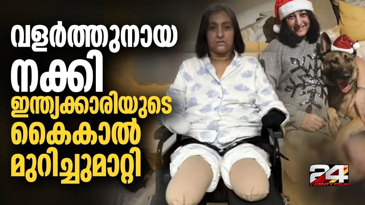 നായ നാക്കിയത് മുറിവിൽ, സെപ്സിസ് ബാധിച്ച് അവയവങ്ങൾ നഷ്ട്ടപ്പെട്ട് സ്ത്രീ Dog Lick Dangerous