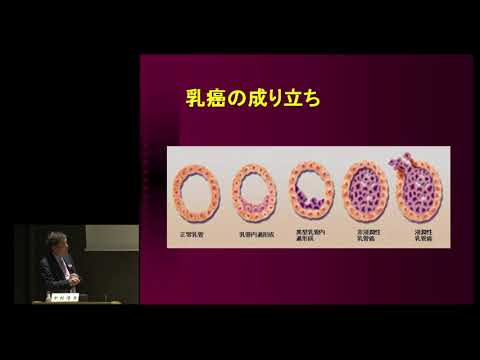 【Japan Cancer Forum2018】乳がん　～初期治療と再発治療、最新情報～