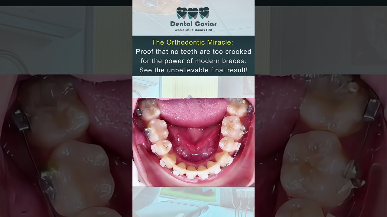 Best Dentist in Multan/ Best Dental Clinic in Multan/ Best  orthodontic treatment in Multan