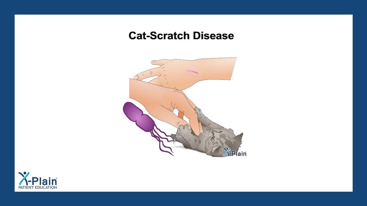Cat-Scratch Disease