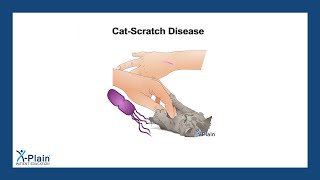 Cat-Scratch Disease