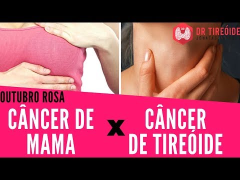 Vídeo: Tireóide E Câncer De Mama: Existe Uma Conexão?