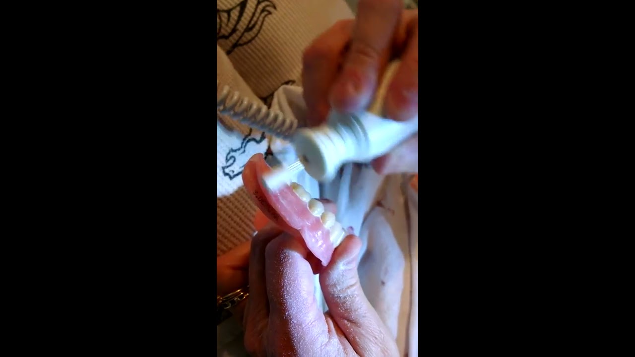 How to file dentures