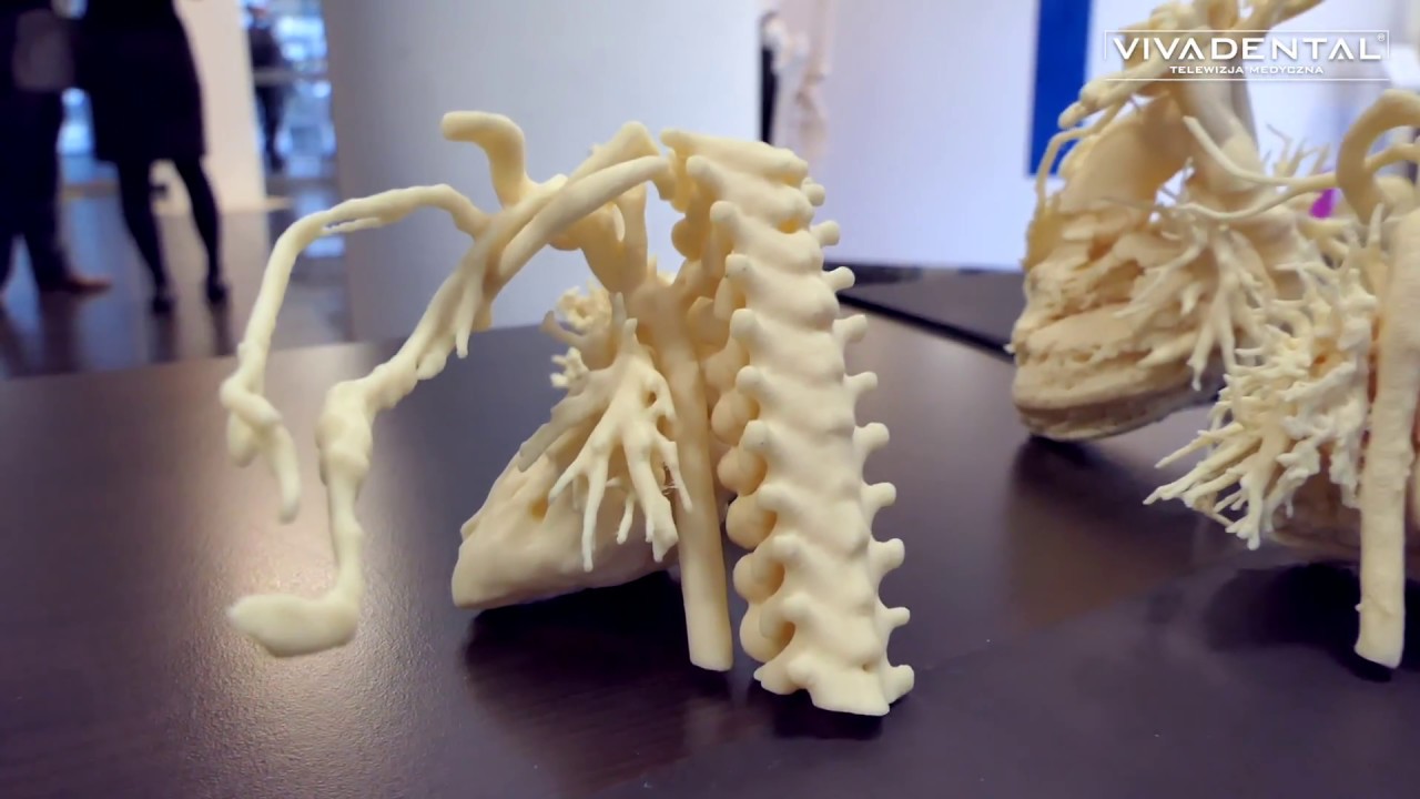 Serce dziecka z drukarki