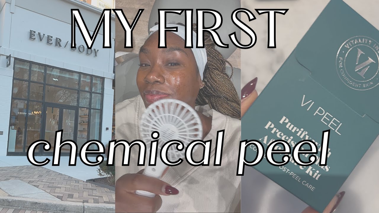 Getting a Chemical Peel for the First Time!