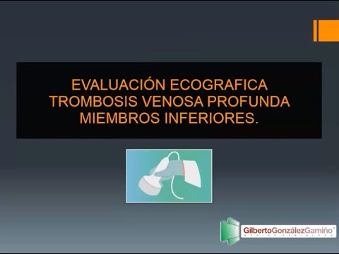 5-9 Trombosis venosa profunda | Dr. Gonzalez