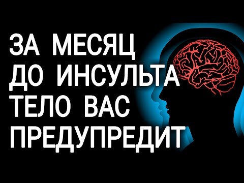 Перед инсультом ваше тело предупредит вас