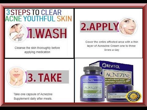 Revitol Acne Treatment Cream Supplement Review | Revitol To Clear Zits