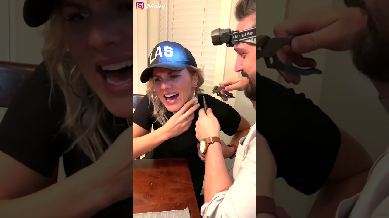 REMOVING AN EARRING STUCK FOR 9 YEARS!!!