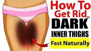 Lighten Your Inner Thighs Naturally At Home, Remove Dark Private Body Parts.