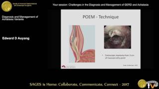 Achalasia: Diganosis & management (everything you wanted to know in about 10 minutes)