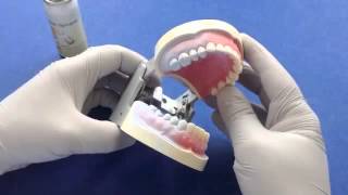 Cerec Overview and Optical Impression