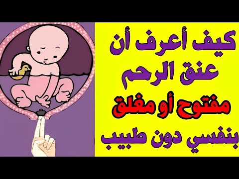 كيف اعرف عنق الرحم مفتوح او مغلق