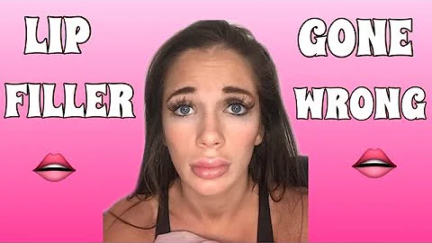 lip injections gone wrong w/ naomi woods