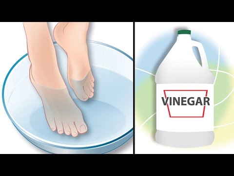 Dip Your Feet In Vinegar For This All-Natural Benefits