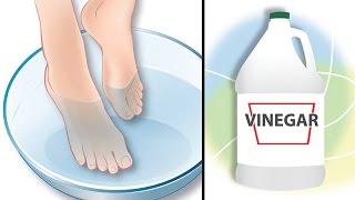 Dip Your Feet In Vinegar For This All-Natural Benefits screenshot 2