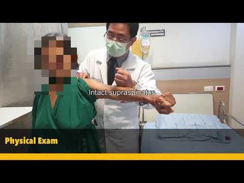Anatomic Total Shoulder Arthroplasty ผ่าตัดข้อไหล่เทียมในภาวะข้อไหล่เสื่อม Dr.SoyPena, Dr.BanchaC