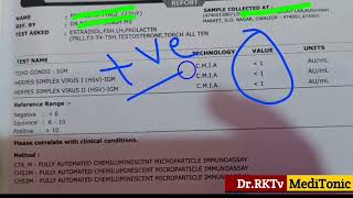 Toxo Gond II | IGM Blood Test  Herpes Simplex Virus I Test | HSV Blood Test Positive Means