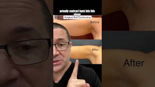 Arm lifts with no scars? || Austin Arm Lift