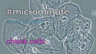 #microminute 21 cheek cells