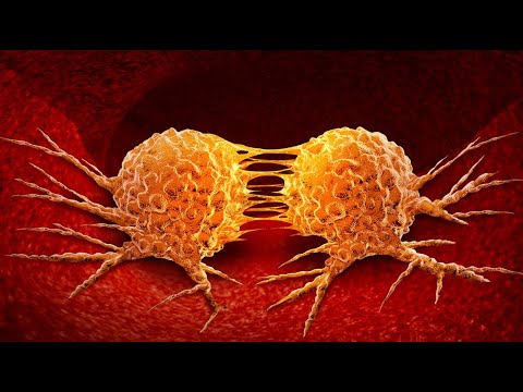 Video: Il cancro è causato da agenti patogeni?
