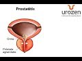 ¿Prostatitis que no es Prostatitis? ¿Cistitis que no es Cistitis? | Urología UROZEN