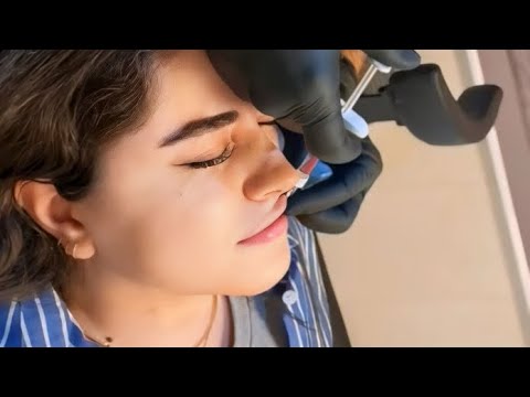 تجربه من از فیلر لب