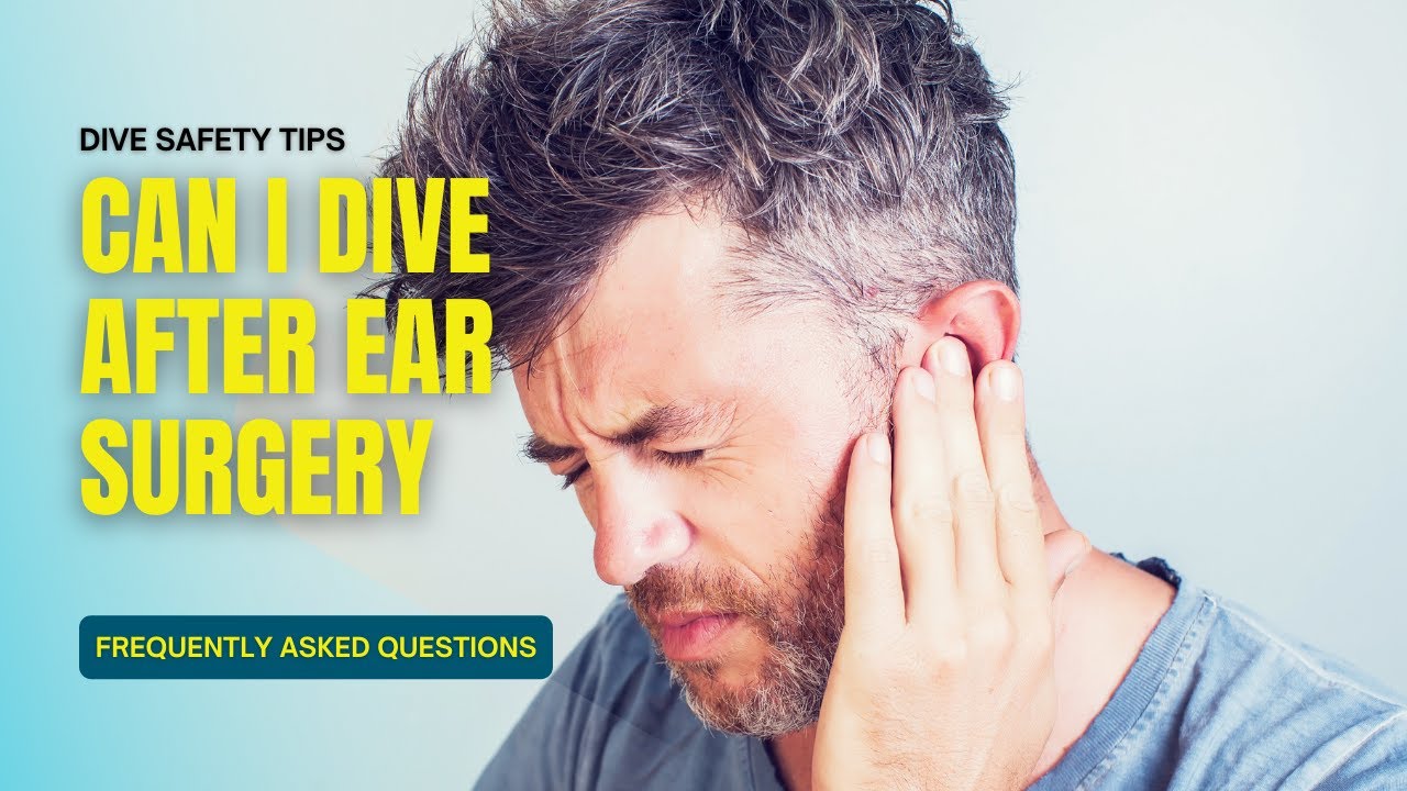 FAQ Can I dive after ear surgery? YouTube