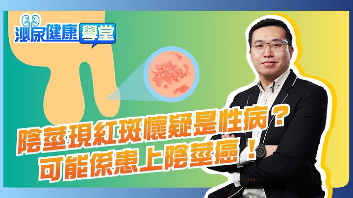 【泌尿健康學堂】 第三十五集：陰莖現紅斑懷疑是性病？可能係患上陰莖癌！ - HKUA 香港泌尿外科學會 - 天天要聞